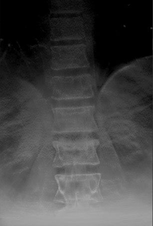 Nanox.ARC